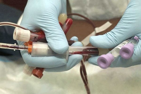 تولید خون مصنوعی برای اولین بار در دنیا