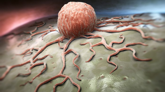 درمان سرطان خون به وسیله مسدود کردن پروتئینی خاص