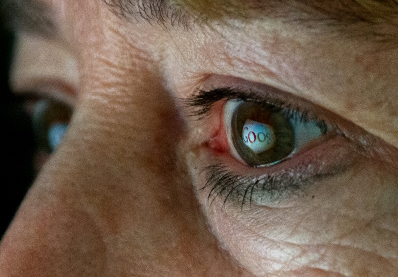  گوگل پتنت لنز هوشمند را به ثبت رسانده که می توان آن را در چشم ها تزریق کرد.