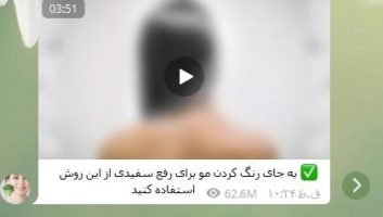 رفع موی سفید زنانه پربازدیدترین پست های تلگرام ایرانی