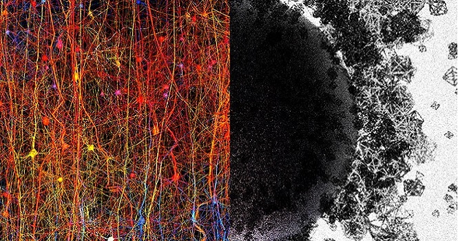مغز انسان می‌تواند ساختار‌های 11 بعدی بسازد!