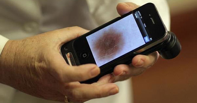 تشخیص سرطان پوست با هوش مصنوعی ؛ پیشرفت هایی فراتر از انتظار
