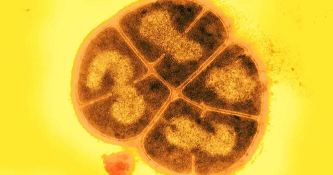 باکتری داینوکوکوس ؛ مقاوم ترین جاندار جهان که 3 سال در فضا زنده ماند!
