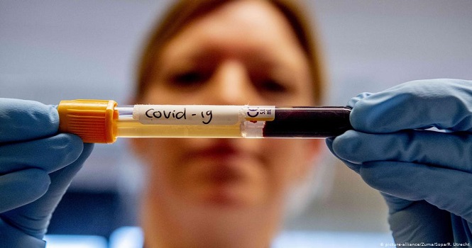 کمپانی فایزر برنده رقابت تولید واکسن کرونا می‌شود؟