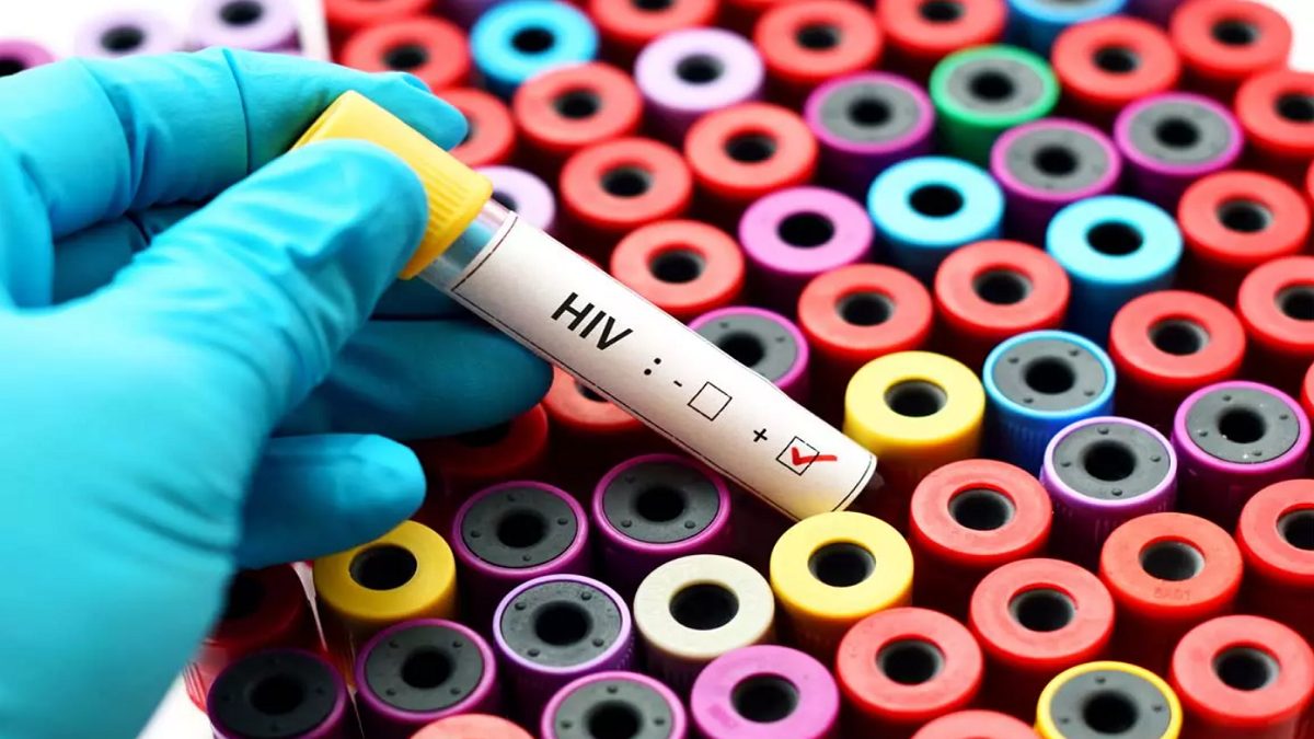 درمان یک بیمار مبتلا به HIV با پیوند سلول‌های بنیادی