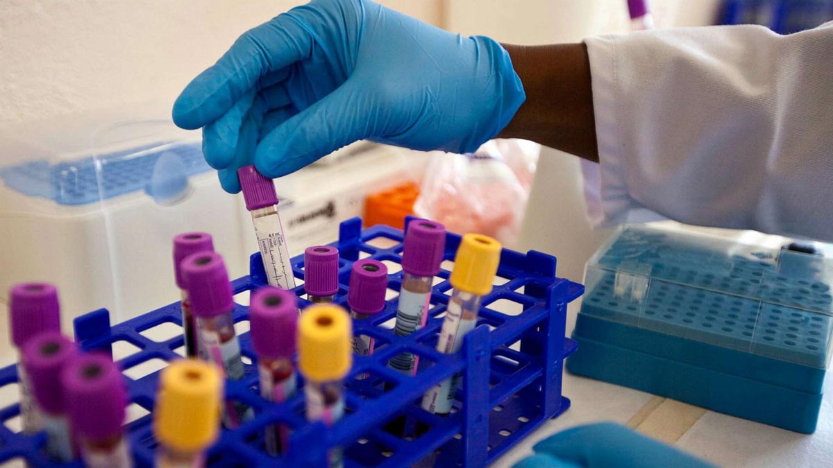 درمان بیماری HIV با پیوند سلول‌های بنیادی محقق شد