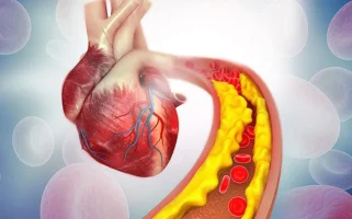تأثیر سکته قلبی بر سلامت مغز