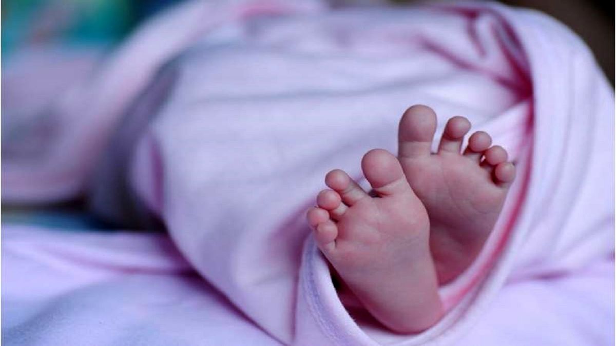 تولد یک نوزاد عجیب‌الخلقه در هند [+عکس]
