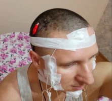 میخایل رادوگا محقق روسی موفق به کاشت تراشه در مغز خود شد