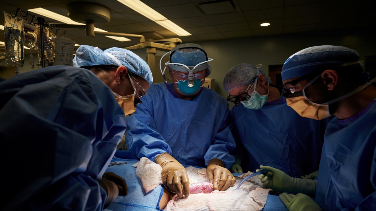 دستاورد بزرگ جراحان: پیوند موفقیت‌آمیز کلیه خوک به انسان