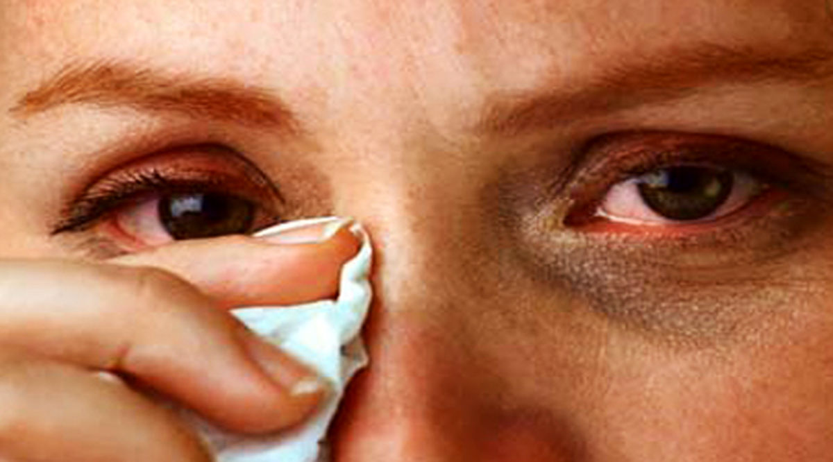 درمان انواع آسیب‌های چشمی با سلول‌های بنیادی میسر شد