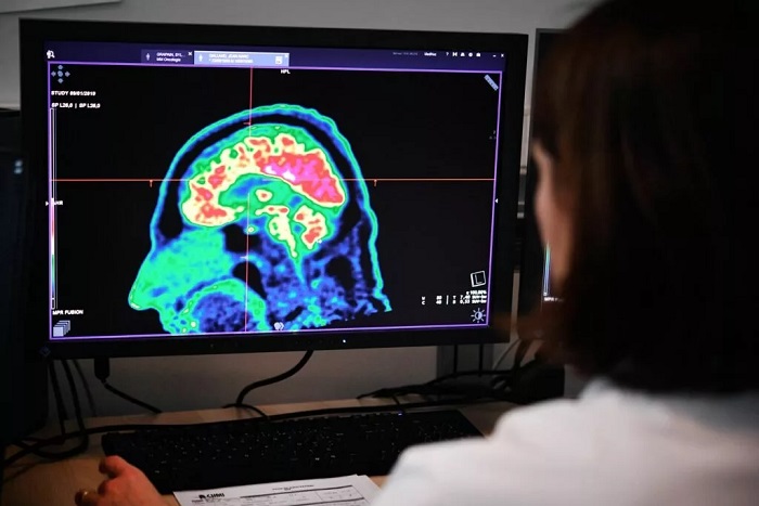 تشخیص نوع تومور مغزی با هوش مصنوعی در عرض 20 دقیقه!