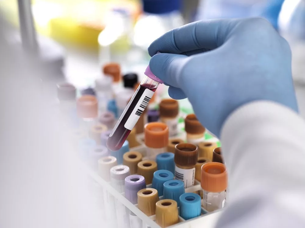 توسعه یک آزمایش خون برای تشخیص انواع سرطان