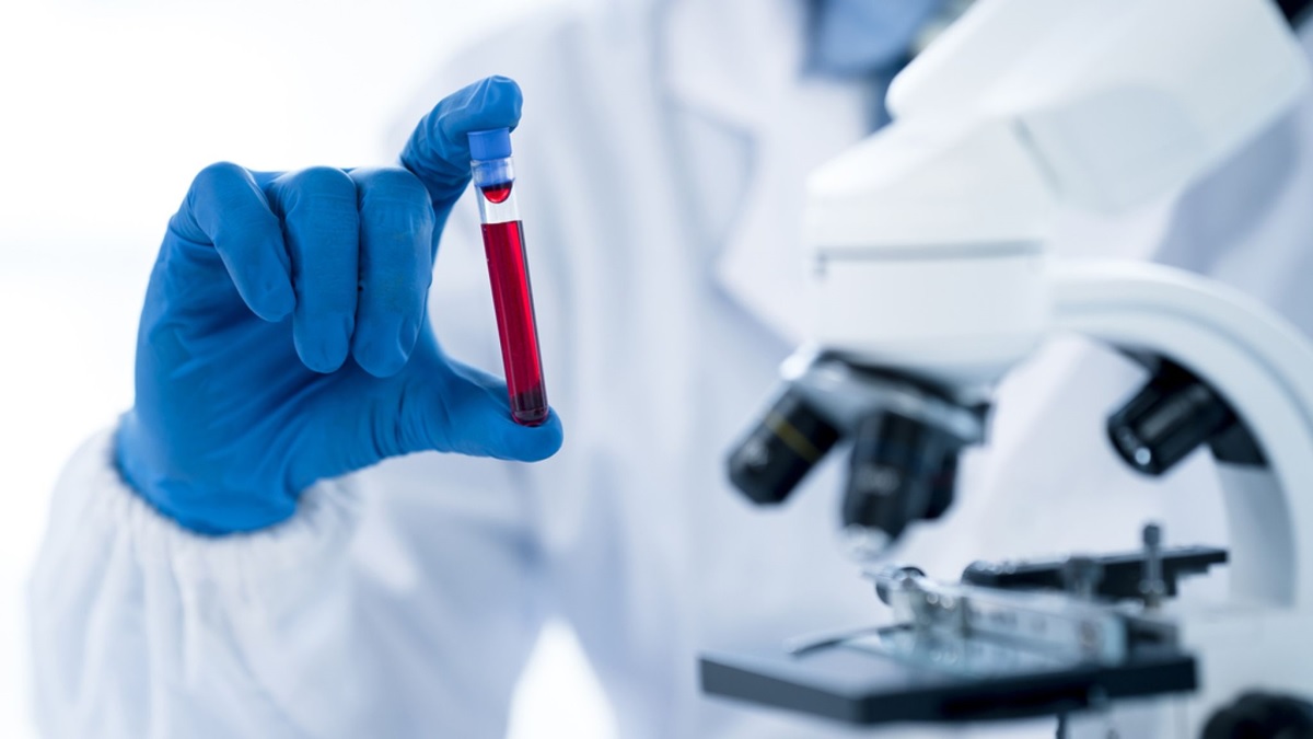 دستاورد بزرگ دانشمندان: یک آزمایش خون برای تشخیص انواع سرطان