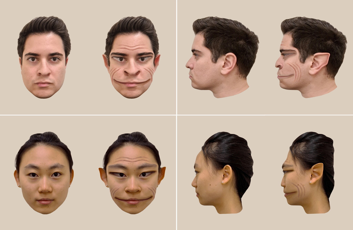 بیماری عجیبی که چهره‌تان را شبیه به فیلترهای تیک تاک می‌کند