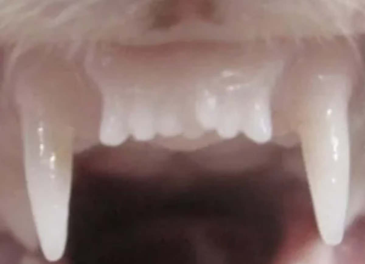 خبر مهم: داروی رشد مجدد دندان‌ها از شهریور ماه وارد فاز آزمایش انسانی می‌شود 